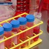 Использование стволовых клеток: Медики сулят революцию