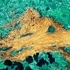 Разработана новая система выявления склонности к болезни Альцгеймера