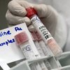 В Киеве госпитализирован мужчина с подозрением на свиной грипп