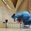 Тернопольская СЭС не подтверждает случаи смерти от гриппа