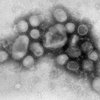 Медики открыли простой способ убивать вирус H1N1