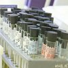 Кровь, которую переливают украинцам, может быть заражена инфекциями