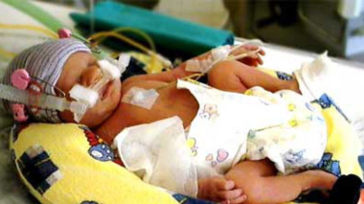 Немецкие медики спасли 275-граммового младенца