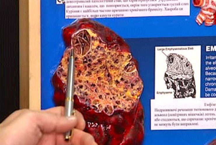 Мир отмечает День без табака