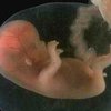 Человеческий эмбрион не чувствителен к боли