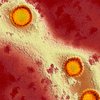Вирус герпеса можно остановить лекарством от ВИЧ