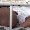 Галлюциногенные грибы могут помочь раковым больным