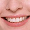Стволовые клетки помогают восстанавливать зубы