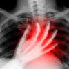 Ученые выяснили причины внезапной остановки сердца