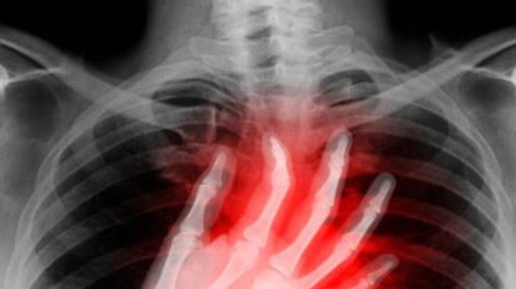 Ученые выяснили причины внезапной остановки сердца