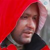 Облитый кислотой замгубернатора Киевской области выходит из больницы