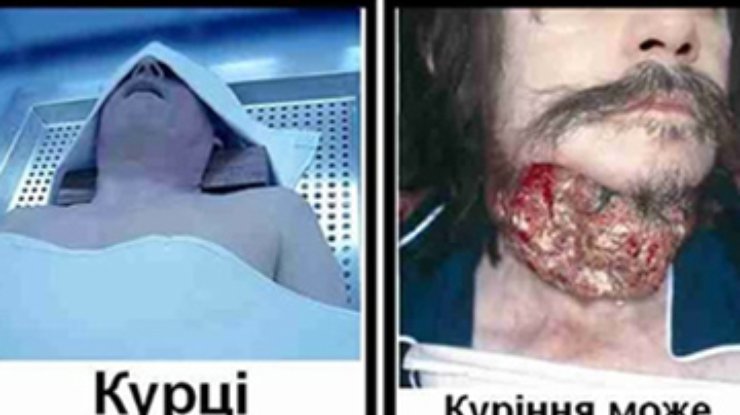 С осени на пачках сигарет появятся "страшные" картинки