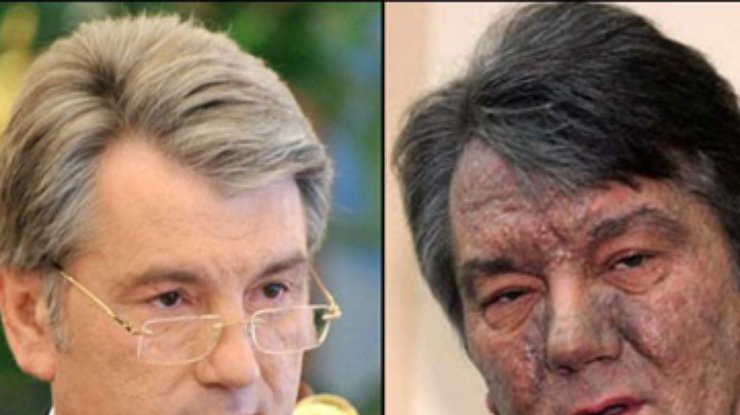 "Дело Ющенко" закроют, если экс-президент не сдаст кровь - Кузьмин