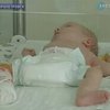 В Днепропетровске во время операции грудной ребенок получил ожоги