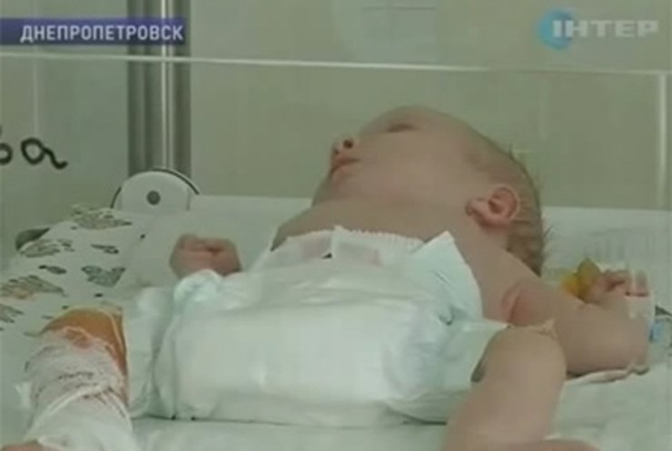 В Днепропетровске во время операции грудной ребенок получил ожоги