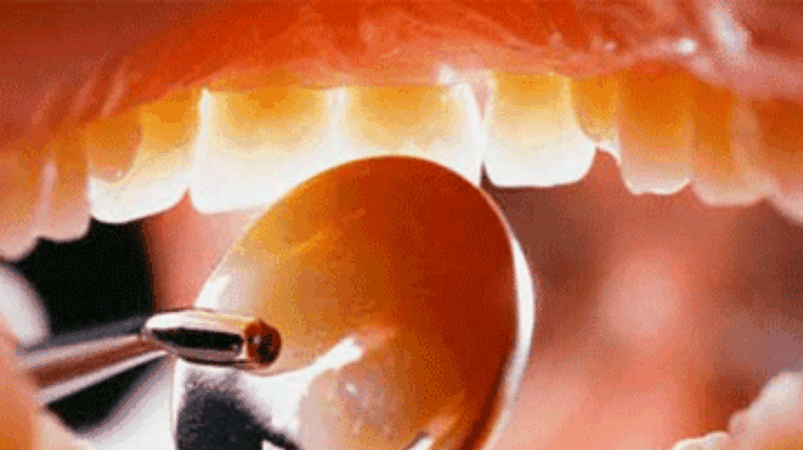 Услуги стоматологов подорожают на 20% - эксперт