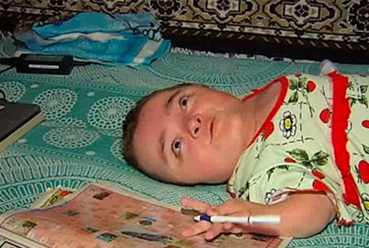 36-летняя винничанка имеет рост меньше одного метра