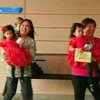 В США выписали из больницы разделенных сиамских близнецов