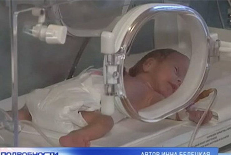 Тернопольским медикам удалось спасти младенца, который весил 500 грамм