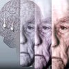 Ученые научились выявлять  симптомы болезни Альцгеймера за 10 лет до болезни