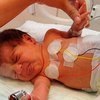 Американские врачи установили 15-минутному ребенку кардиостимулятор