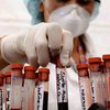 Американские ученые обнаружили новые группы крови