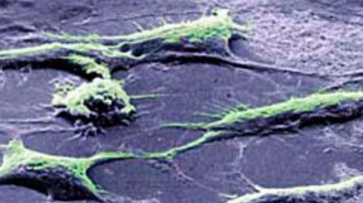 Ученые обнаружили стволовые клетки в женских яичниках