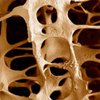 Избыток витамина E может вызывать остеопороз - ученые