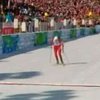 Тора Бергер призналась, что выступала на Олимпиаде-2010 с раком кожи