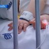 Итальянские врачи пересадили искусственное сердце младенцу