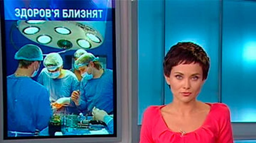 Донецкие медики занялись сиамскими близнецами из Краматорска