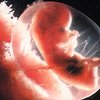 Ученые изобрели механизм защиты плода от имунных атак