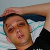 В Николаеве милиционер жестоко избил 21-летнего парня