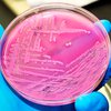 Ученые узнали причину смертоносной эпидемии кишечной инфекции в Европе