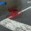 В Луганске умер рекламщик, сбитый машиной неделю назад