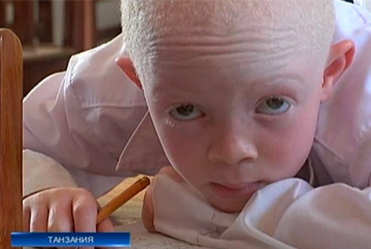 Танзанию охватила эпидемия ритуальных убийств альбиносов