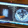 Донецкий хирург забыл в теле пациента зажим