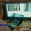 В Украине продолжается эпидемия туберкулеза