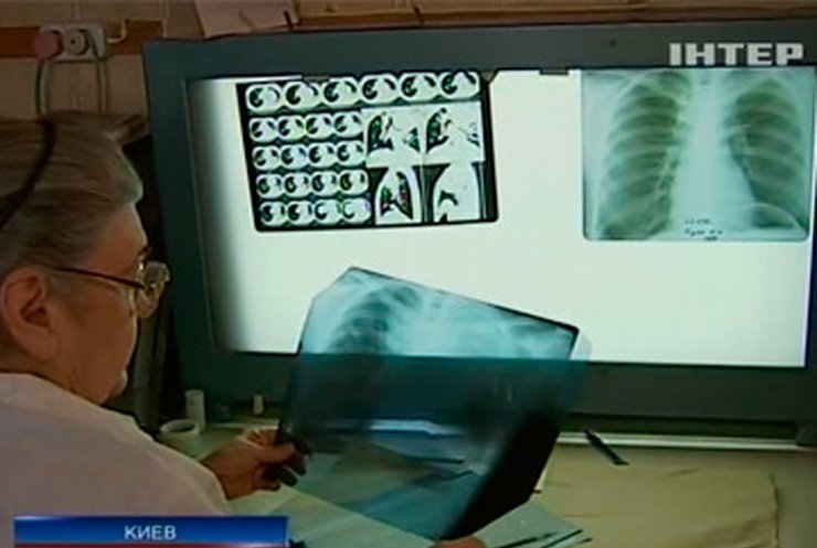 В Украине продолжается эпидемия туберкулеза