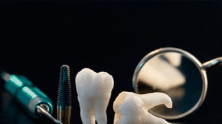 Медики выявили прямую зависимость между потерей зубов и ухудшением памяти