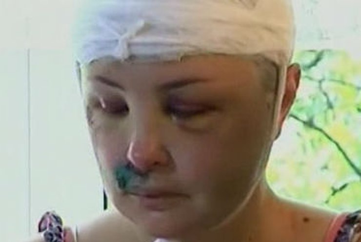 На Николаевщине милиционеры зверски избили и изнасиловали женщину