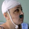 Таксиста-насильника заставил врать замначальника РОВД Врадиевки, – прокуратура