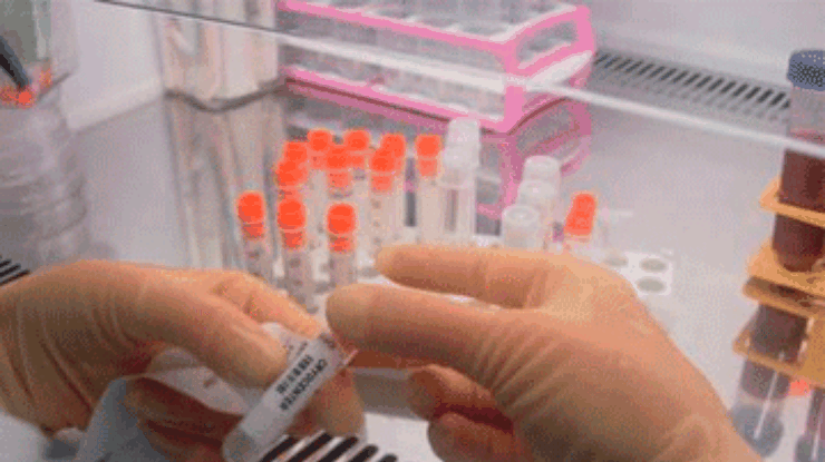 В Японии тестируют лечение при помощи стволовых клеток от пациента