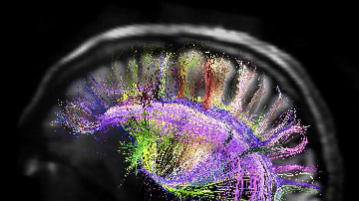 Искусственный мозг помог ученым открыть источник мозговых сигналов