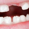 Китайским ученым удалось получить зубную ткань из человеческой мочи
