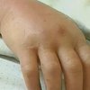 Буковину атаковали полчища змей