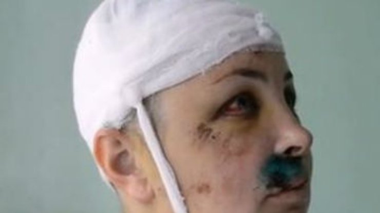 Адвокат Крашковой: По "Врадиевскому делу" будет двое потерпевших