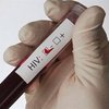 Экспресс-тест на ВИЧ для развивающихся стран одобрили в США