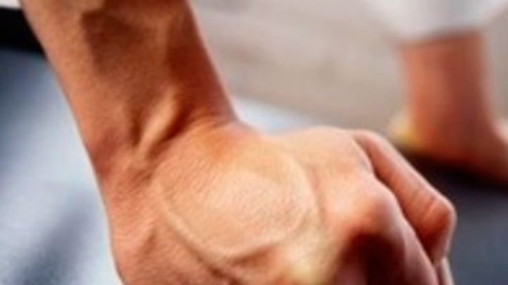 Помощника нардепа "Батьківщини" избили железным прутом