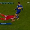Аргентинский футболист лишился трех зубов, сделав подкат вперед головой